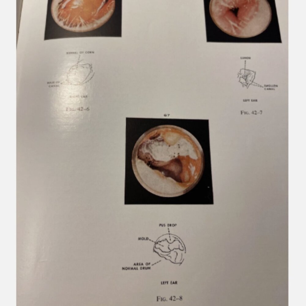 Diseases Of The Nose Throat And Ear 11th Ed John Jacob Ballenger - Picture 9 of 11